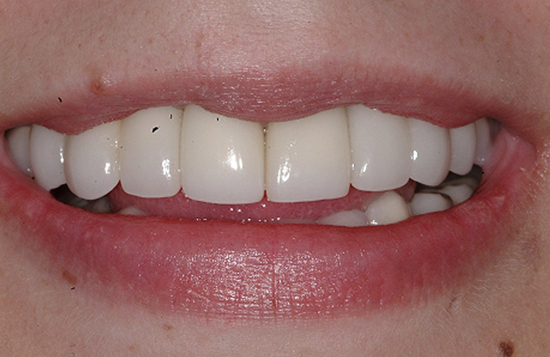 treatment at Pristine Dental
