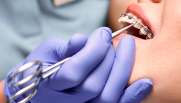 Orthodontics