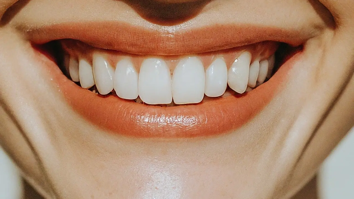Teeth Gap Filling Vs. Other Cosmetic Dental Procedures: Which One Is Right for You?