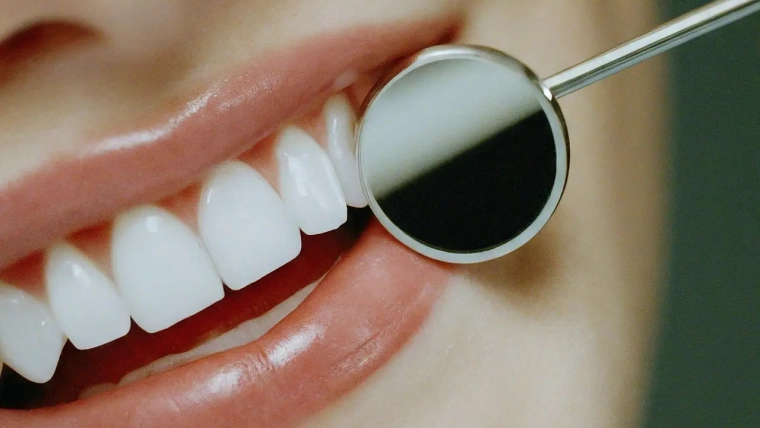 How Professional Teeth Cleaning Can Enhance Your Smile