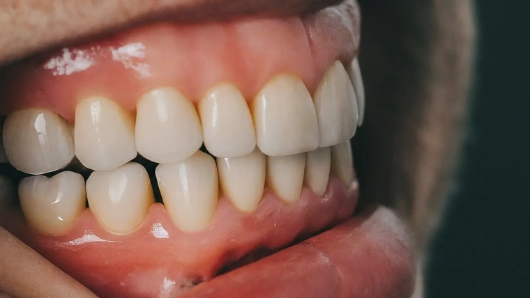 What Is Prosthodontics and Why Might You Need It?
