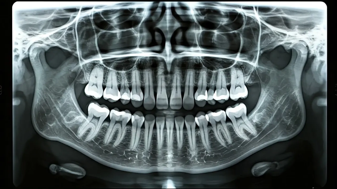 ¿Qué es una radiografía dental y por qué es necesaria?