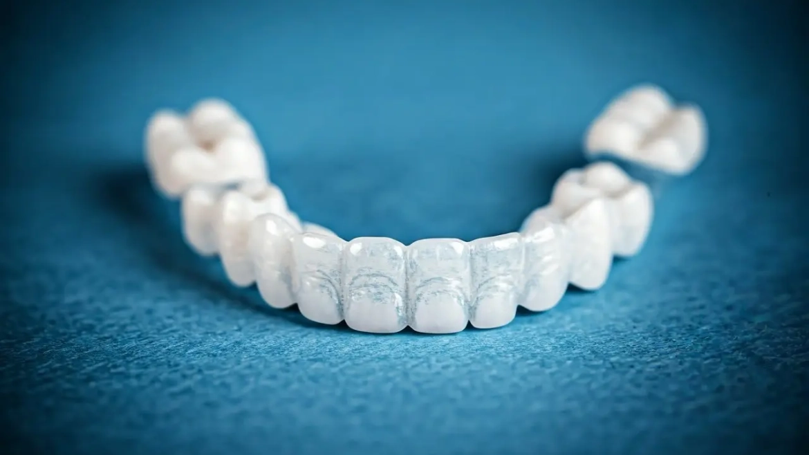 The Ultimate Guide to Choosing a Dental Night Guard