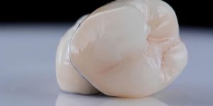 dental crowns near you