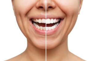 cosmetic dentistry
